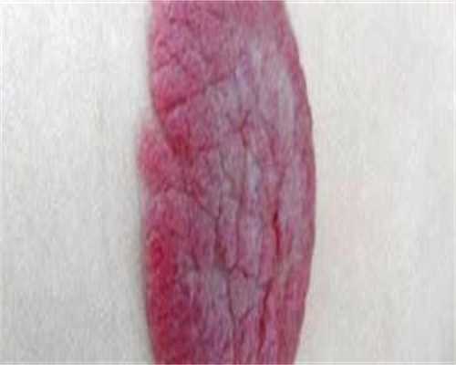 宿州试管私立医院有哪些宿州有做试管婴儿的吗