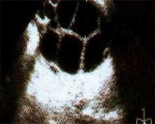 哈尔滨三代试管安徽捐卵中心的费用大约？哈尔滨试管婴儿要多少钱