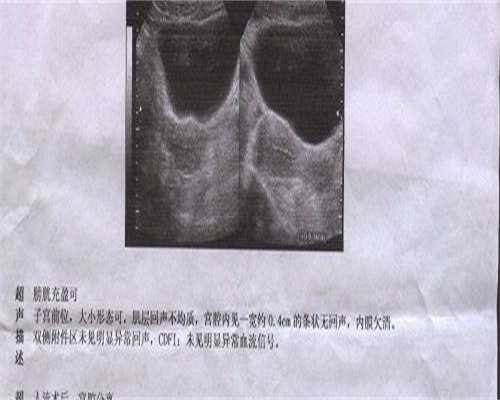 代怀安徽捐卵市场会有代母基因吗？