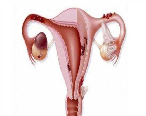 第三代试管婴儿：安徽试管成功率有多高?附安徽试管费用预估!