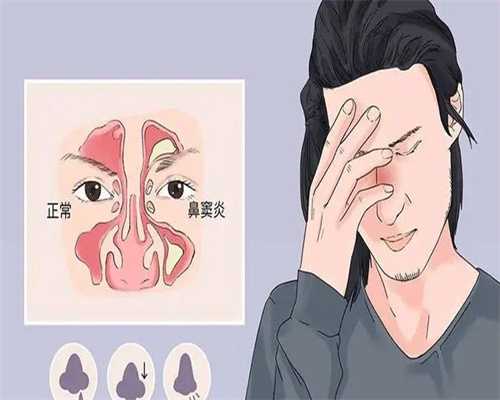 专家来告诉你，轻度宫腔粘连可以自愈吗