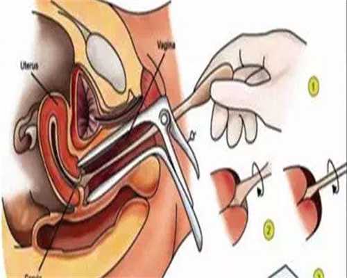 美国hrc生殖医疗中心：美国三代试管合肥借卵做试管程序养囊的成功率