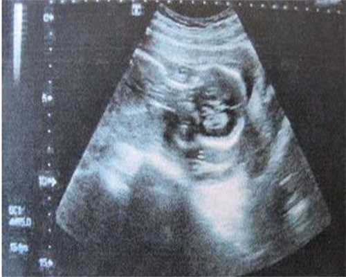 长沙借卵第三代试管合肥私人捐卵群包生男孩需要多少钱