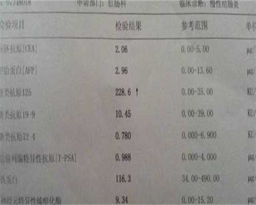 哪些药物会导致安徽如何判断能供卵畸形