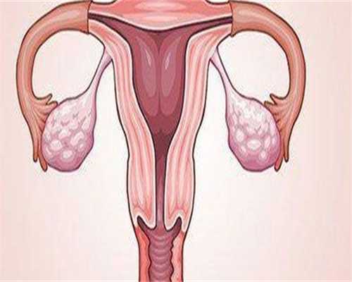 代生价格：每天热敷肚子可以促进子宫内膜生长发育和改善血流吗？