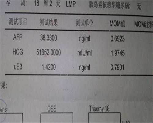 试管婴儿签约是什么意思？附试管签约注意事项