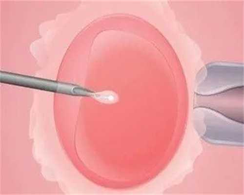 和老公备孕一年左右一直没怀就去医院做了很详细的检查